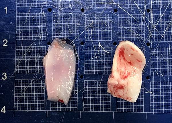 M SeptalConchalCartilage.jpg M SeptalConchalCartilage.jpg