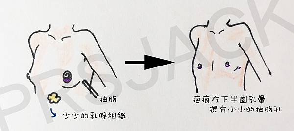 FTMChest01.jpg FTMChest01.jpg