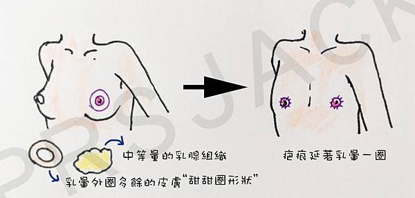 FTMChest02.jpg FTMChest02.jpg