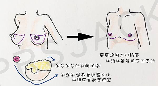 FTMChest03.jpg FTMChest03.jpg