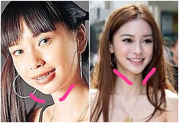 Chin03.jpg Chin03.jpg