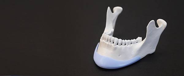 04.3D墊下巴價格費用價錢.jpg 04.3D墊下巴價格費用價錢.jpg