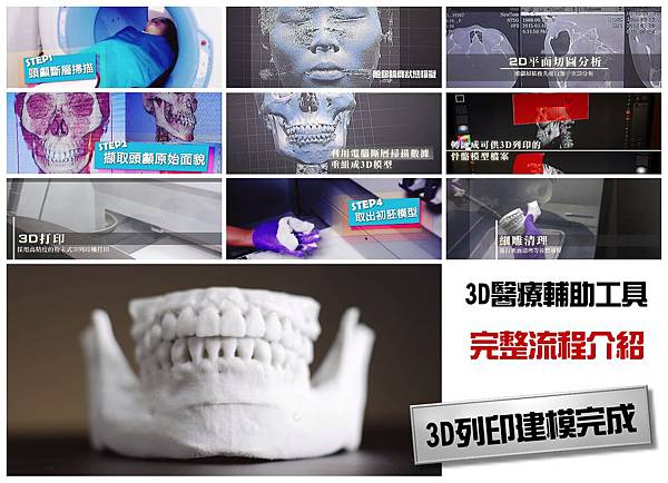 06.3D列印墊下巴手術步驟.jpg 06.3D列印墊下巴手術步驟.jpg