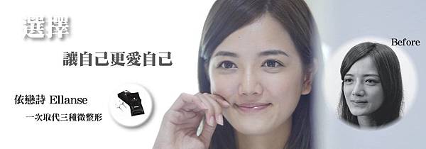 少女針完美奇蹟依戀詩蘋果肌法令紋注射 少女針完美奇蹟依戀詩蘋果肌法令紋注射