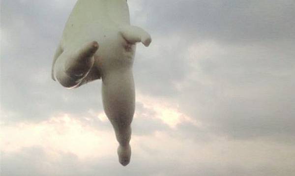 04肉毒桿菌瘦小腿.jpg 04肉毒桿菌瘦小腿.jpg