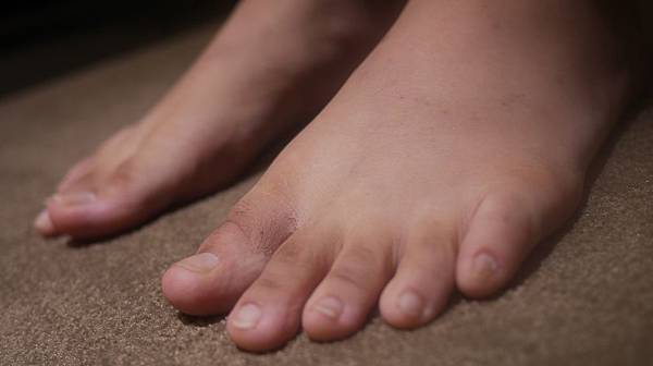 02.腳趾頭看起來很髒.jpg 02.腳趾頭看起來很髒.jpg