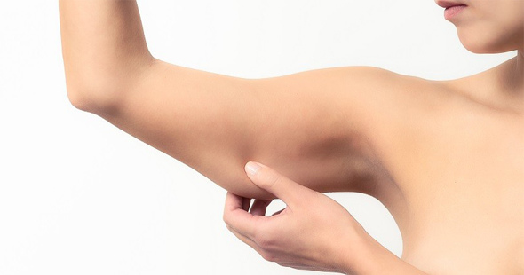 01.手臂粗壯肥大蝴蝶袖抽脂手術權威醫師推薦.jpg 01.手臂粗壯肥大蝴蝶袖抽脂手術權威醫師推薦.jpg