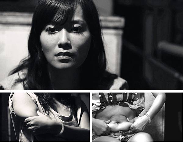 1.手臂腹部副乳超音波抽脂手術.jpg 1.手臂腹部副乳超音波抽脂手術.jpg