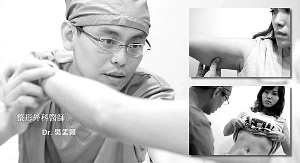 3手臂腹部副乳飛塑抽脂手術.jpg 3手臂腹部副乳飛塑抽脂手術.jpg