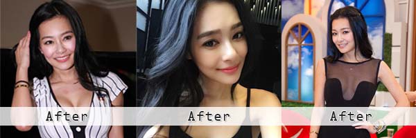 王思佳疑似隆鼻隆乳割雙眼皮整形? 王思佳疑似隆鼻隆乳割雙眼皮整形?