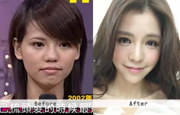 李毓芬整形疑雲再起 顏值神進化網友驚 根本不同人 藝人整形hot搜查 特搜專欄 整形醫美特搜 台灣網友口碑推薦整形醫美完整情報