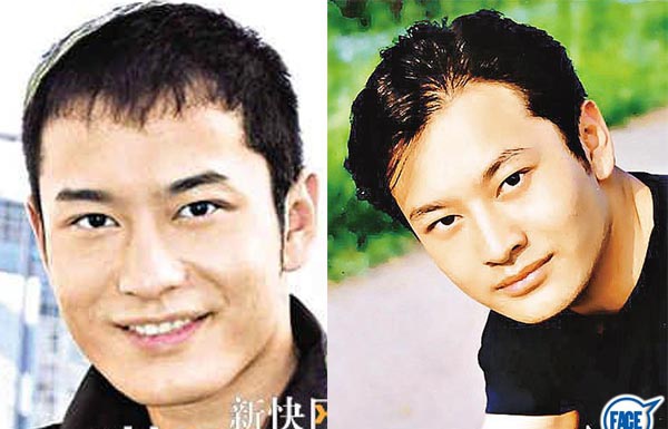 黃曉明疑似削骨隆鼻墊下巴照片前後比對 黃曉明疑似削骨隆鼻墊下巴照片前後比對