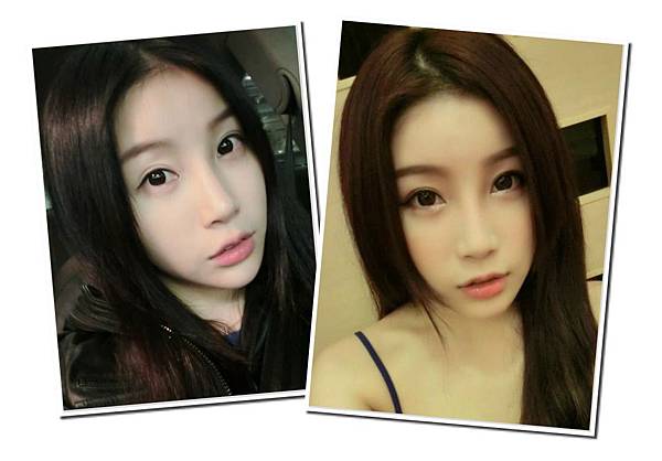 04舒舒曾恩琦削骨矯正牙齒整牙墊下巴.jpg 04舒舒曾恩琦削骨矯正牙齒整牙墊下巴.jpg