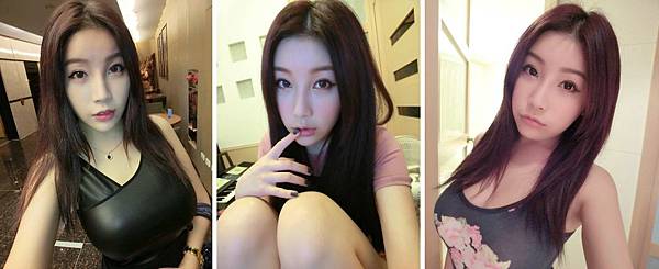 02舒舒曾恩琦削骨隆乳自體脂肪移植豐頰.jpg 02舒舒曾恩琦削骨隆乳自體脂肪移植豐頰.jpg