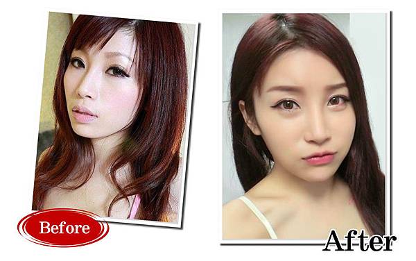 03舒舒曾恩琦整形整哪裡哪一家整形.jpg 03舒舒曾恩琦整形整哪裡哪一家整形.jpg