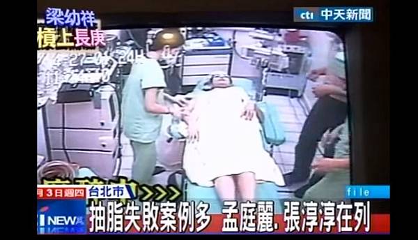 03抽脂手術失敗後遺症風險副作用 03抽脂手術失敗後遺症風險副作用