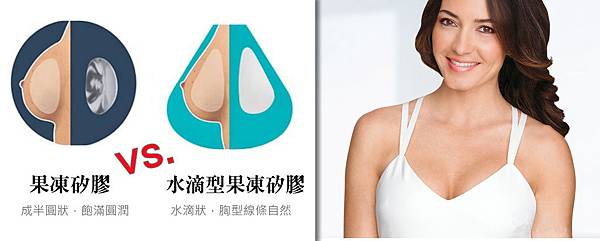 002水滴型果凍矽膠隆乳手術蕭奕君多少錢觸感案例.jpg 002水滴型果凍矽膠隆乳手術蕭奕君多少錢觸感案例.jpg
