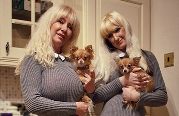 英國大媽瘋狂整型 只為看起來與女兒更相像! 英國大媽瘋狂整型 只為看起來與女兒更相像!