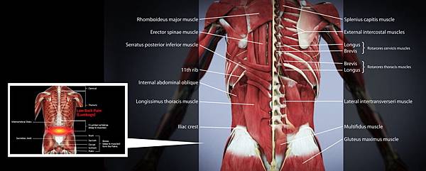 03腰痛可分為哪幾種，形成原因為何？.jpg