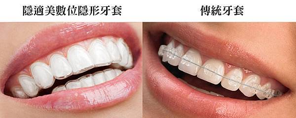 04隱適美台灣台北台中台南高雄專業權威醫師醫生推薦.jpg 04隱適美台灣台北台中台南高雄專業權威醫師醫生推薦.jpg