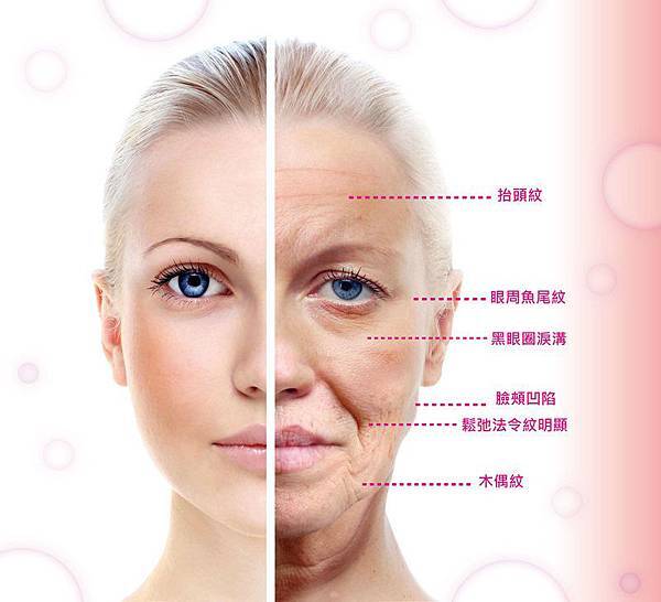 06XEOMIN®天使肉毒桿菌可維持多久.jpg 06XEOMIN®天使肉毒桿菌可維持多久.jpg