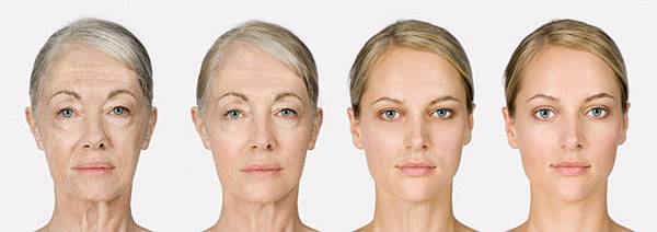 02音波拉提拉皮機器比較術後失敗效果副作用.jpg 02音波拉提拉皮機器比較術後失敗效果副作用.jpg