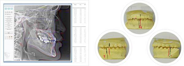 02正顎手術權威醫師醫生.jpg 02正顎手術權威醫師醫生.jpg