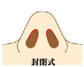 台中隆鼻權威 格嘉整形外科 台中隆鼻權威 格嘉整形外科