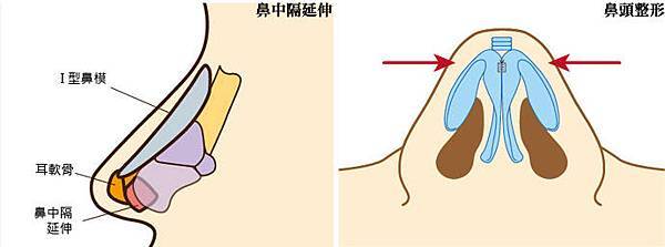 台中隆鼻權威 格嘉整形外科