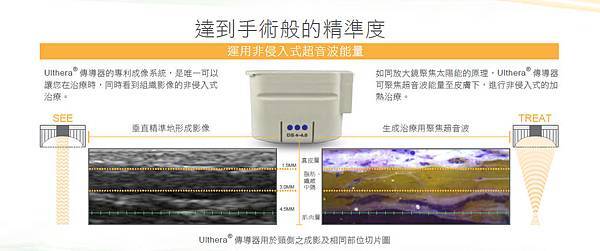 台中極線音波拉皮可達到手術般的精準度