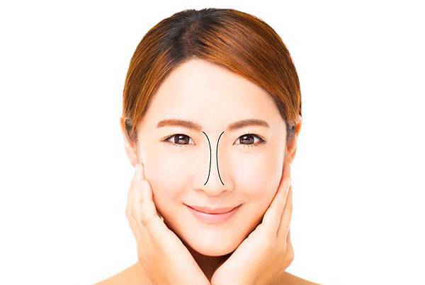 隆鼻的美麗曲線(dorsal aesthetic line) 隆鼻的美麗曲線(dorsal aesthetic line)