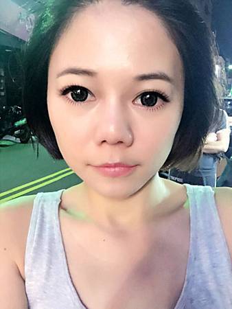 韓式隆鼻修復後 韓式隆鼻修復後