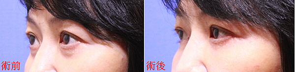 未命名........1.png 未命名........1.png