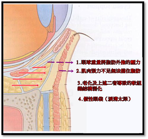 lower lid anatomy....png lower lid anatomy....png
