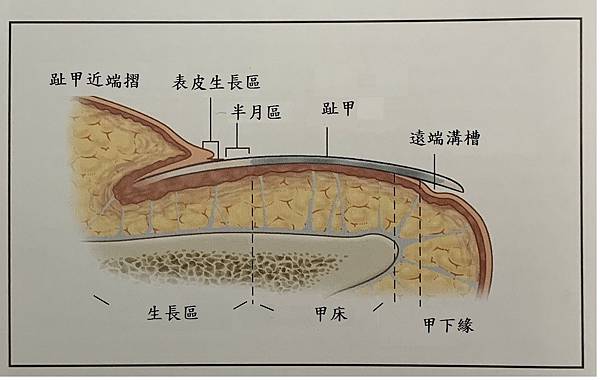 甲溝炎範例１.jpg