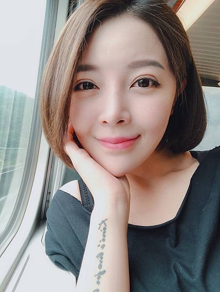 術後4M.jpg 術後4M.jpg