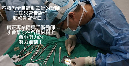 自體肋軟骨隆鼻缺點,自體肋軟骨彎曲調整,自體肋軟骨隆鼻,博恩妍