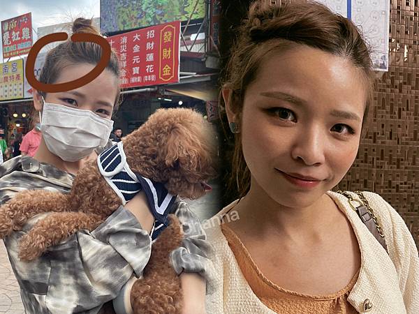 台北內湖 | 育毛粉餅髮際線推薦 > Sheen.希恩美學設