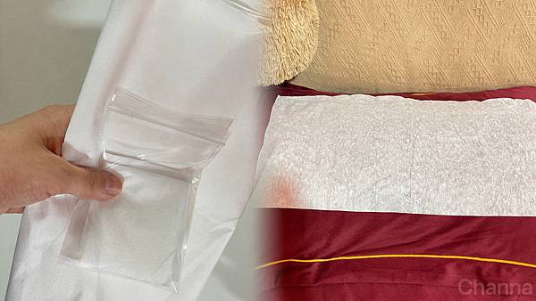 台北內湖 | 育毛粉餅髮際線推薦 > Sheen.希恩美學設