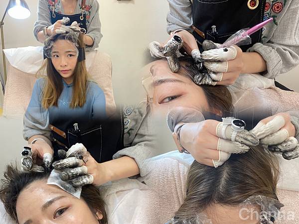 台北內湖 | 育毛粉餅髮際線推薦 > Sheen.希恩美學設