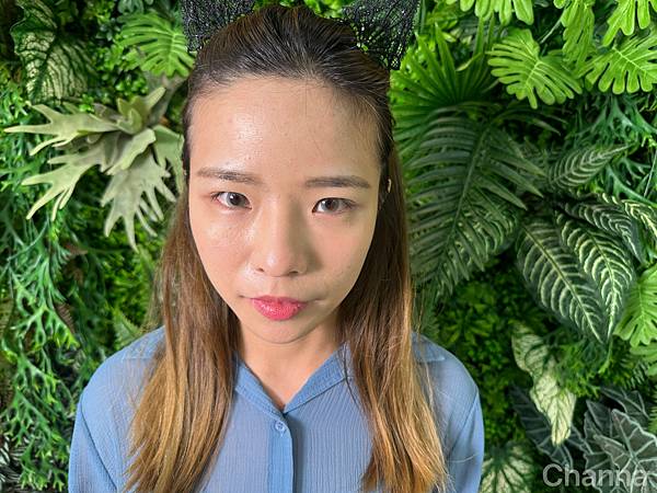 台北內湖 | 育毛粉餅髮際線推薦 > Sheen.希恩美學設