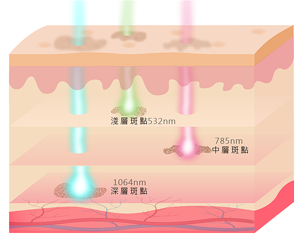 3波震碎斑點圖-01.png