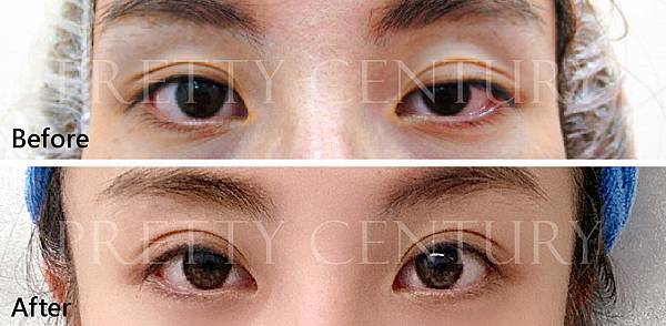 21-1020_prettycentury_cpt_eyes_4.jpg