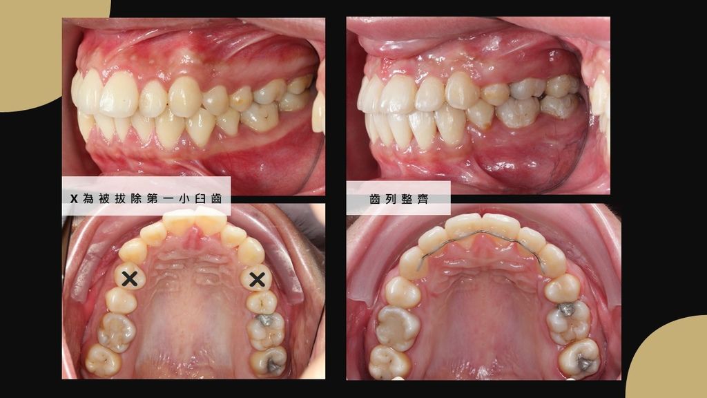 投影片8.JPG