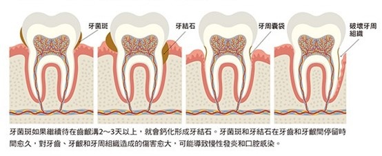 圖2