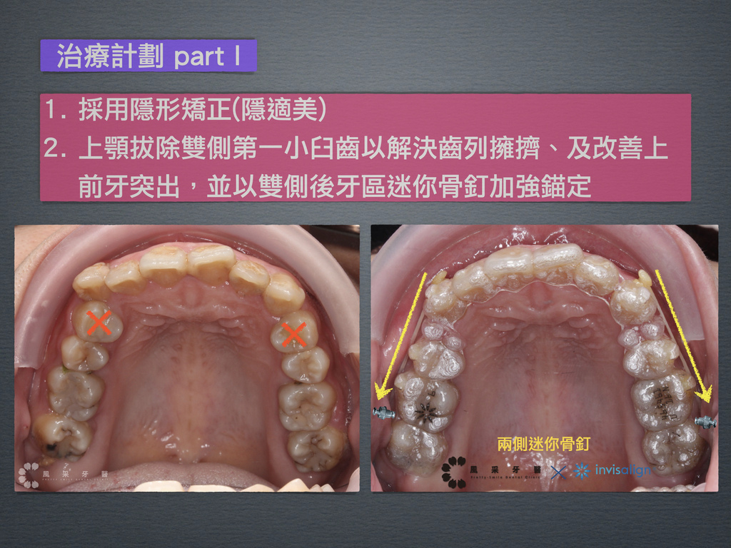 0821203游嘉涵 keynote 網路行銷用.005.jpeg