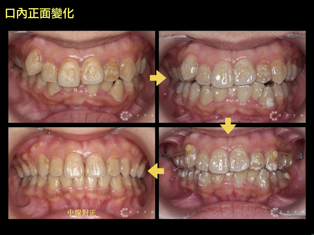 0821203游嘉涵 keynote 網路行銷用.012.jpeg