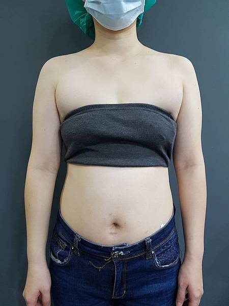 [心得] 我終於去作了手臂雷溶1