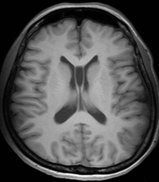 D220986294MRI0.jpg