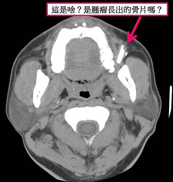 投影片1.JPG